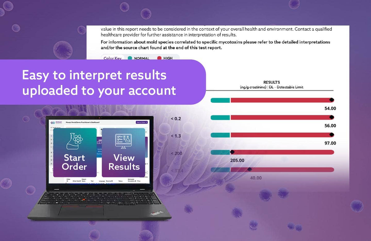 Promotional graphic for a software or service tool showing a laptop with a test results dashboard and a large text banner reading 'Easy to interpret results uploaded to your account' on a purple background with floating droplet graphics.